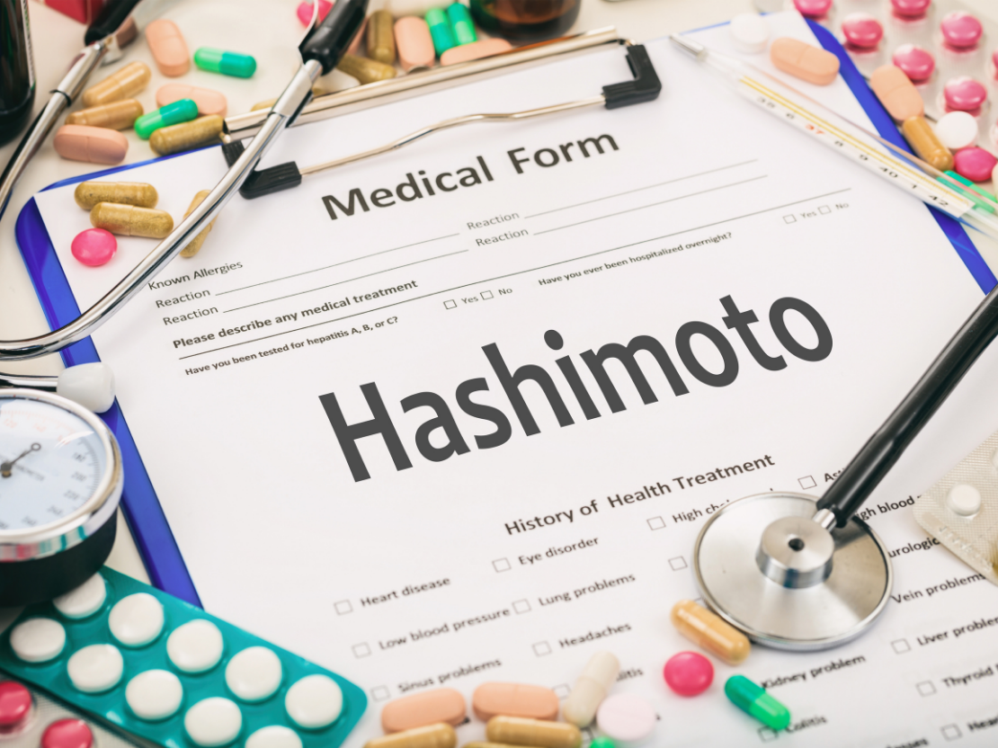 Hashimoto und Vitalpilze - Natürliche Möglichkeiten zu Behandlung